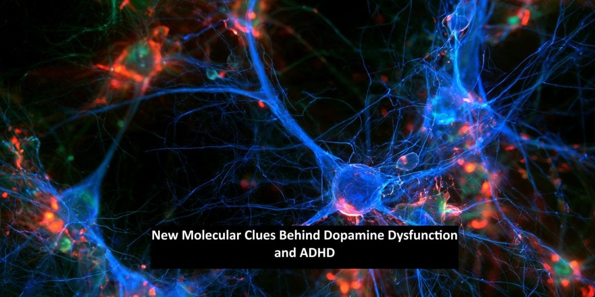 3D scientific visualization of a dopamine synapse in the striatum showing neurotransmitter release, vesicle membrane fusion, and D2 receptor complexes. Caption reads "New Molecular Clues Behind Dopamine Dysfunction and ADHD."
