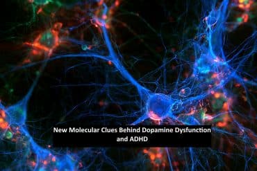 3D scientific visualization of a dopamine synapse in the striatum showing neurotransmitter release, vesicle membrane fusion, and D2 receptor complexes. Caption reads "New Molecular Clues Behind Dopamine Dysfunction and ADHD."