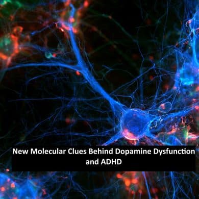 3D scientific visualization of a dopamine synapse in the striatum showing neurotransmitter release, vesicle membrane fusion, and D2 receptor complexes. Caption reads "New Molecular Clues Behind Dopamine Dysfunction and ADHD."
