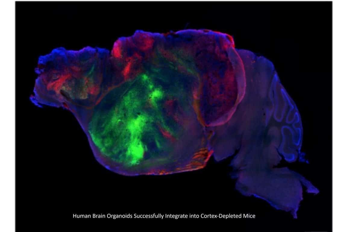 Lab-Grown Human Brain Tissue Restores Brain Circuitry in Living Mice