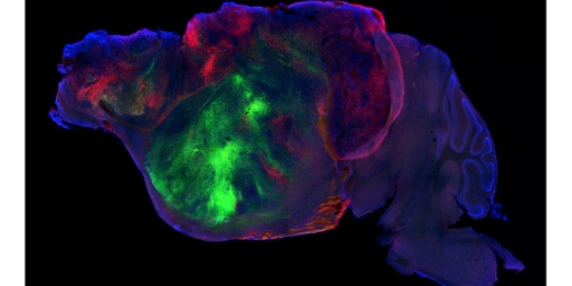 This shows the side view of the hybrid mouse brain. Caption on image reads "Human Brain Organoid Integrating into Mouse Cerebral Cortex".