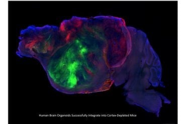 This shows the side view of the hybrid mouse brain. Caption on image reads "Human Brain Organoid Integrating into Mouse Cerebral Cortex".