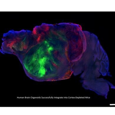 This shows the side view of the hybrid mouse brain. Caption on image reads "Human Brain Organoid Integrating into Mouse Cerebral Cortex".