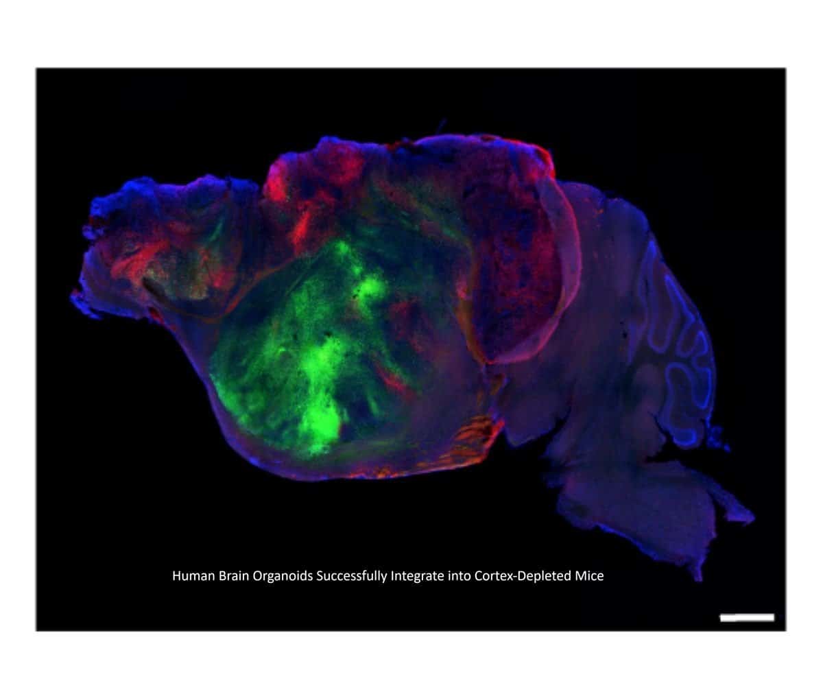 This shows the side view of the hybrid mouse brain. Caption on image reads "Human Brain Organoid Integrating into Mouse Cerebral Cortex".