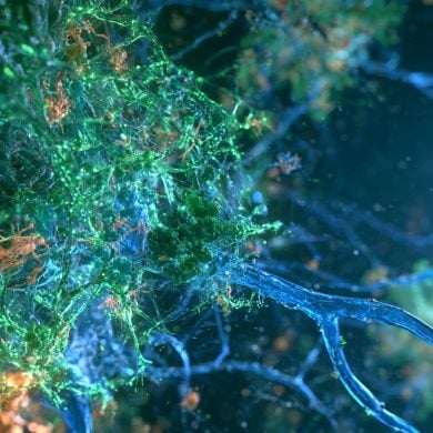 This shows neurons.