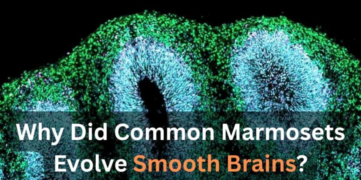 This shows a brain organoid.