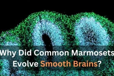 This shows a brain organoid.