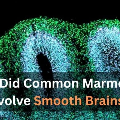 This shows a brain organoid.
