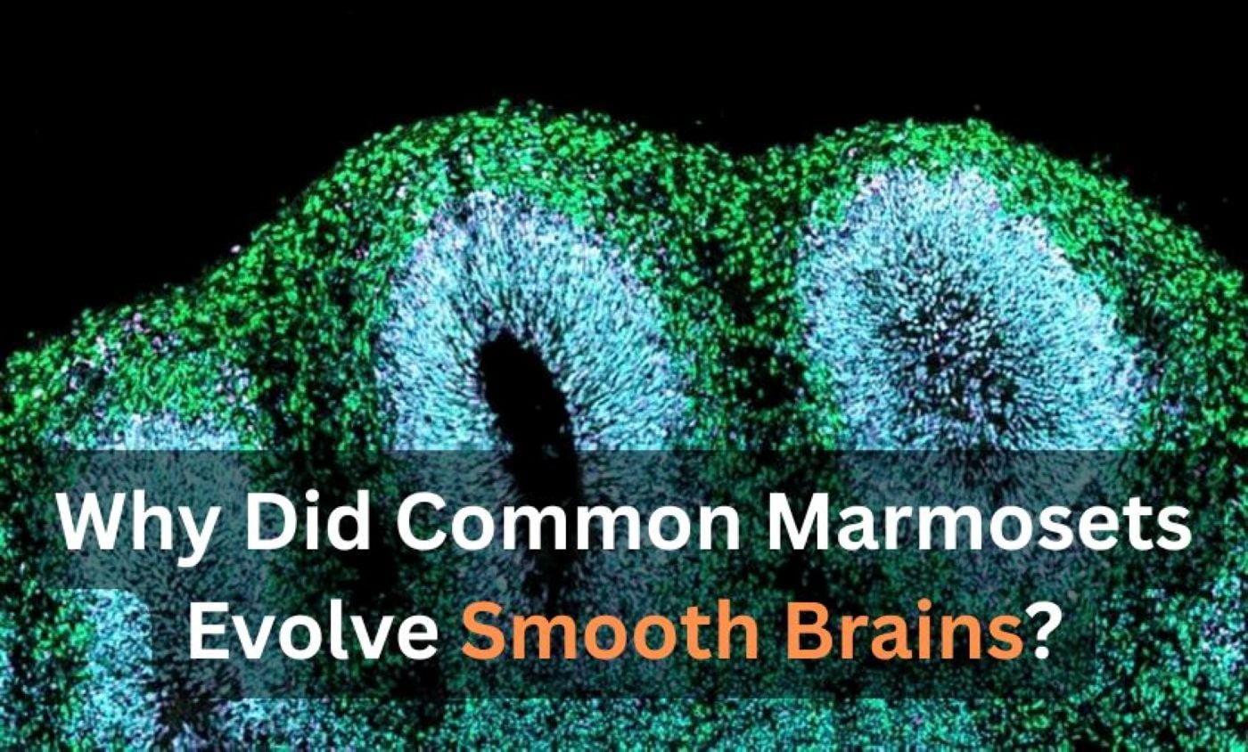 This shows a brain organoid.