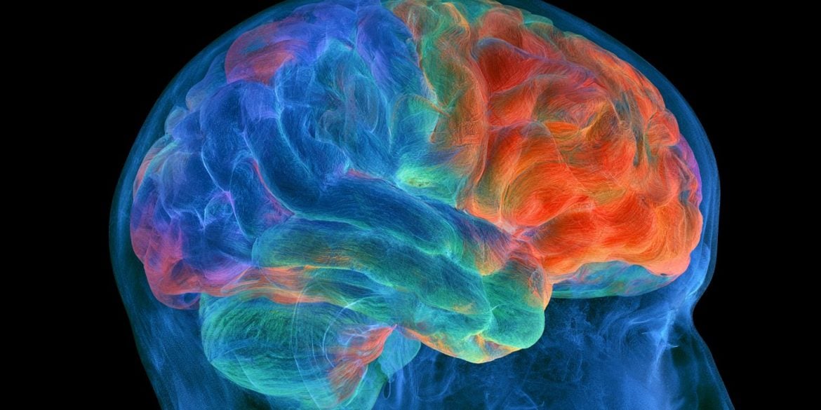 This shows a brain.