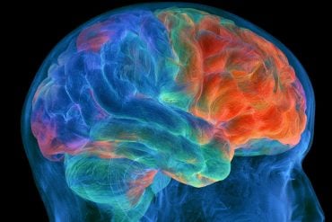 This shows a brain.