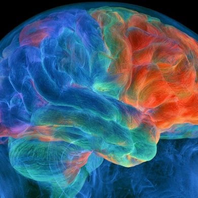 This shows a brain.
