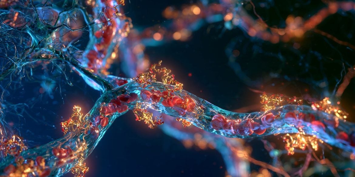 This illustration shows vascular flow.