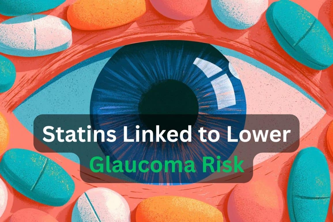 Statins Linked to Reduced Glaucoma Risk and Slower Progression