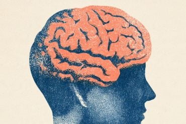 This shows a head and a brain
