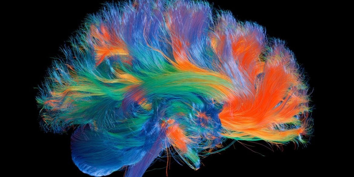 This shows a connectome of the brain.