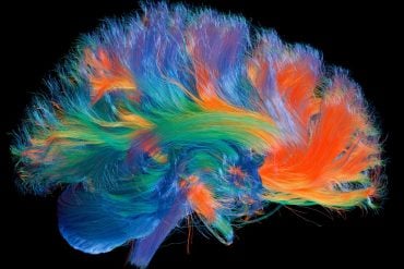 This shows a connectome of the brain.
