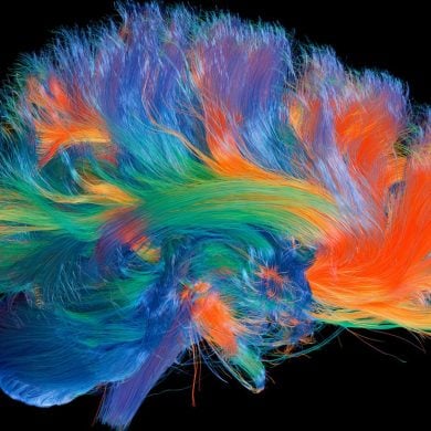 This shows a connectome of the brain.