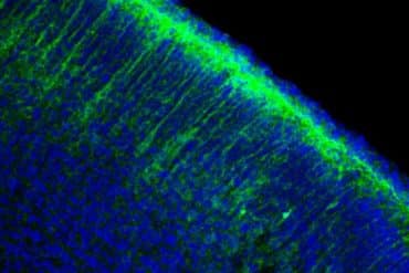 This shows neurons in a brain slice.