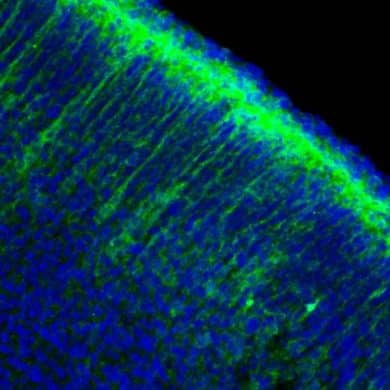 This shows neurons in a brain slice.