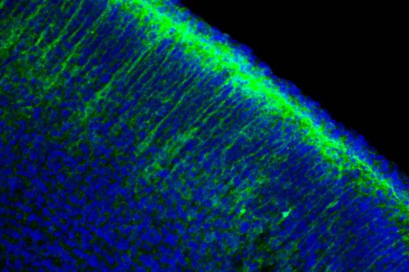 Photo: Neuroscience News Anglemans syndrome enzyme neurodevelopment
