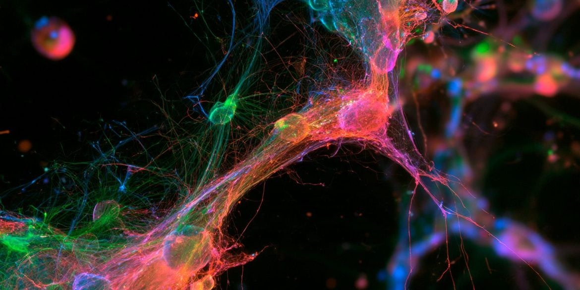 This shows astrocytes.