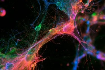 This shows astrocytes.