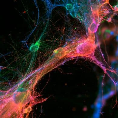 This shows astrocytes.