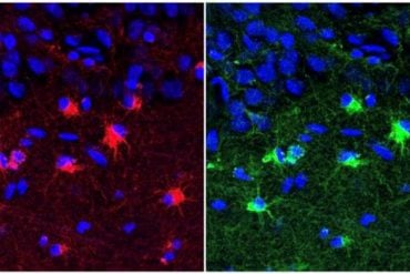 This shows hippocampal astroglia.