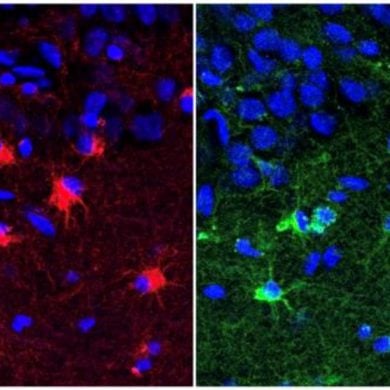 This shows hippocampal astroglia.