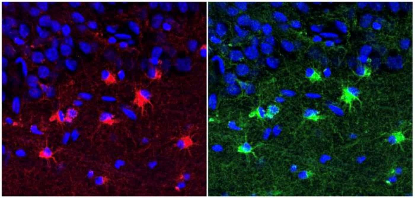 This shows hippocampal astroglia.
