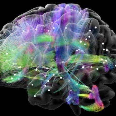 This shows a connectome of a brain.