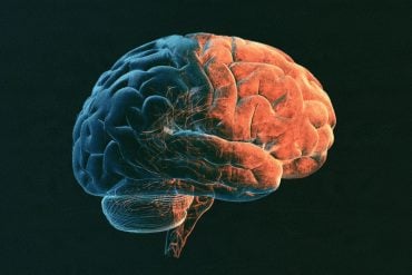 This shows a brain.