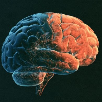 This shows a brain.