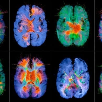 This shows brain scans.