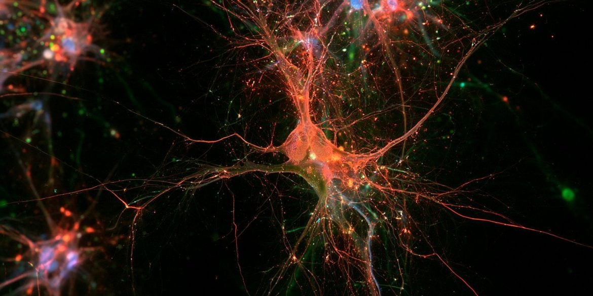 This shows neurons.