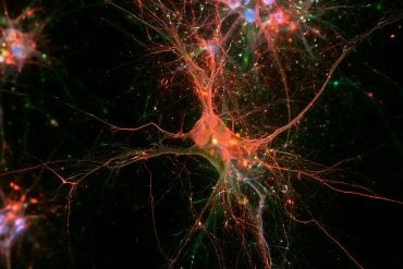 This shows neurons.