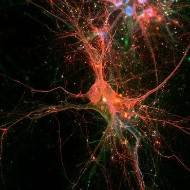 This shows neurons.