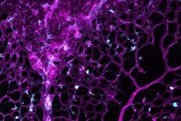 This shows cerebral blood vessels.