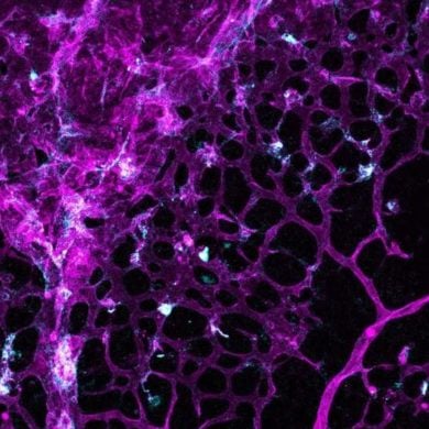 This shows cerebral blood vessels.