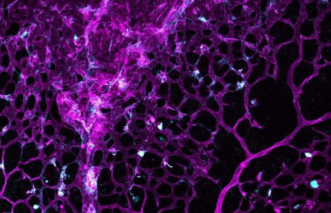 This shows cerebral blood vessels.