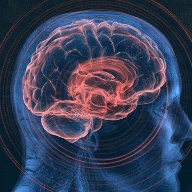 This shows a head and a brain.