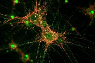 This shows neurons.