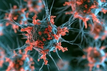 This shows the HSV1 virus.
