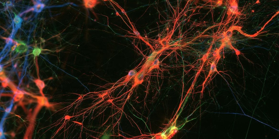 This shows neurons.