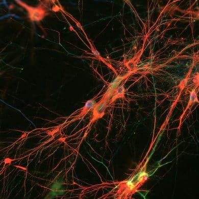 This shows neurons.