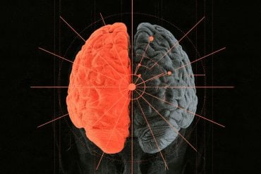 This shows a brain. Half of it is red.