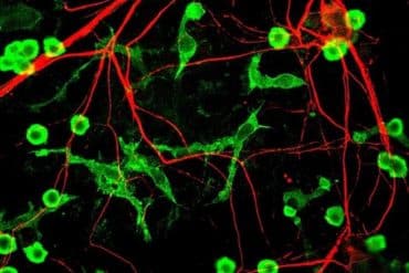 This shows macrophages.