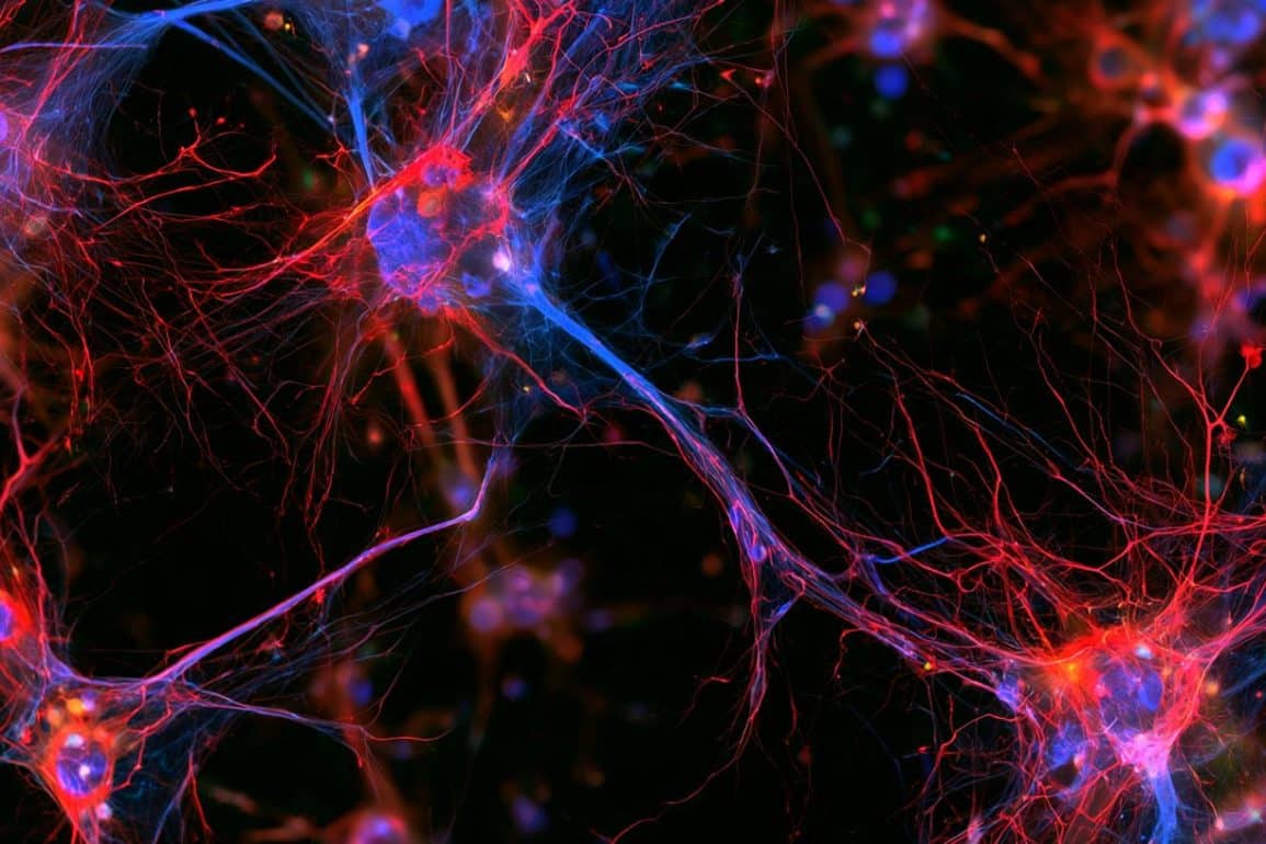 Microglia Rescue Vulnerable Dopamine Neurons in Parkinsons