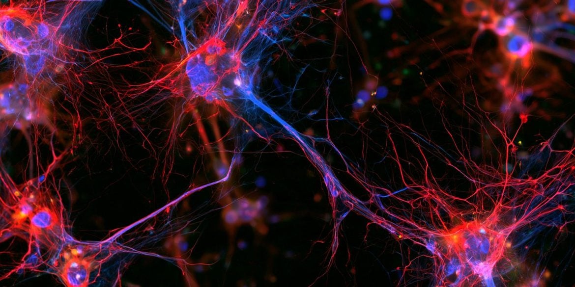 This shows microglia and neurons.